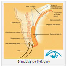 blefaritis